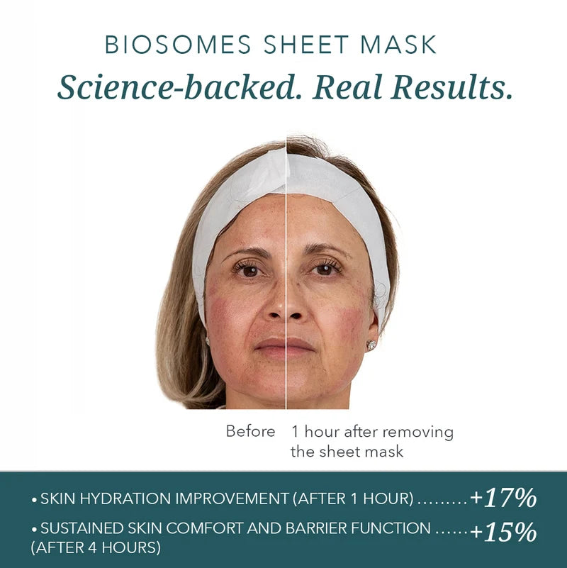 AnteAGE Biosome Sheet Mask – Pack of 10